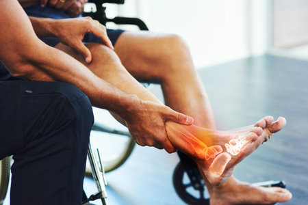 Rehabilitation, physiotherapist and help a patient with foot injury, pain and muscle tension...
