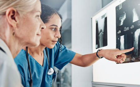 Medical, x ray and surgery with doctors planning in meeting for leg scan, strategy or research. Medicine, consulting and radiology image with healthcare surgeons for diagnosis, treatment or operationの写真素材