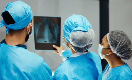 Medical, x ray and surgery with doctors planning in meeting for mri scan, strategy or research....