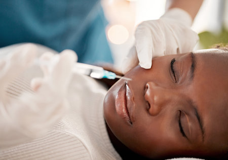 Face, syringe and skincare, black woman at spa with collagen injection for skincare and beauty treatment. Dermatology, cosmetics and person at salon with needle in skin for anti aging facial process.の写真素材