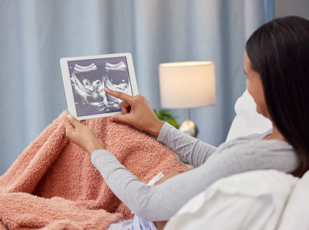 Pregnant, ultrasound scan and mother with tablet in bed with digital x ray of baby, infant and...