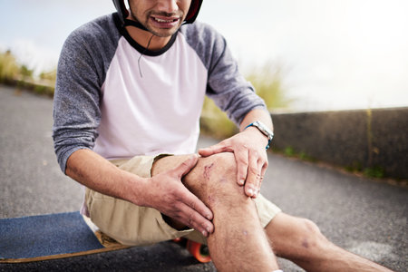 Injury, man and knee pain after skateboarding accident, practice and learning to skate. Active, bad...