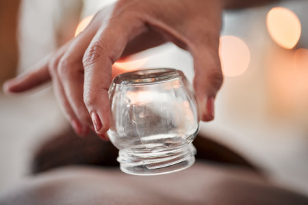 Cupping therapy, glass vacuum cup in hand and woman at spa, therapist with deep tissue massage and wellness. Closeup, treatment at luxury resort with cosmetic, body care and health with acupunctureの写真素材