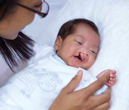 Newborn, cleft palate and parent care for a baby happy in a home bed with a smile in a bedroom or medical centre. Health, healthcare and young child or kid bonding with mother with love and comfortの写真素材