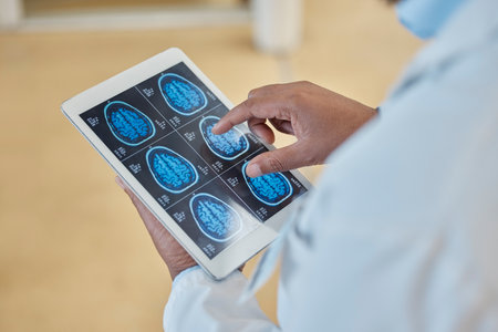Brain scan, xray and closeup of a doctor with a tablet for a neurology consultation or surgery. Healthcare, digital technology and hands of surgeon analyzing a mri image in medical hospital or clinicの写真素材
