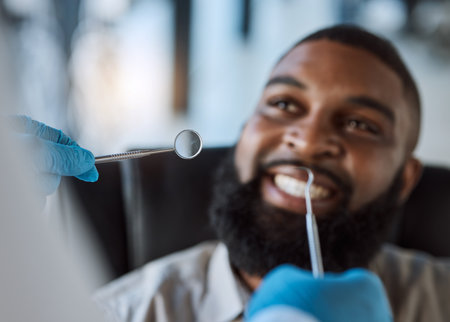 Man, hands and dentist tools for cleaning in clinic for medical treatment, teeth whitening or veneer hygiene. Smile, mirror and dental excavator for African patient in mouth health checkup or consultの写真素材