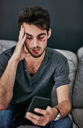 Domestic violence, phone or man with face bruise on sofa for emergency contact, help or web search for abuse report hotline at home. Facial, wound or scared victim on smartphone safe house researchの写真素材