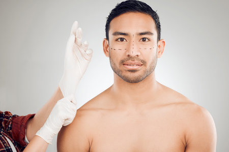 Plastic surgery, hands and drawing marks on face for man, rhinoplasty and cosmetic procedure in studio. Male person, surgeon and needle or syringe placement for facelift, nose job and blepharoplastyの写真素材