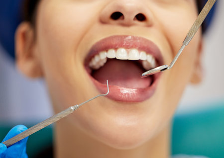 Equipment, mouth and teeth with woman at dentist for oral hygiene or dental care appointment closeup. Checkup, healthcare and medical tools with happy patient in chair at clinic for cleaning or examの写真素材