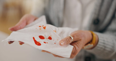 Woman, hands and tissue with blood in home for respiratory crisis, bacteria and chronic illness. Healthcare, problem and female person with toilet paper in house for tuberculosis, disease or bleedingの写真素材