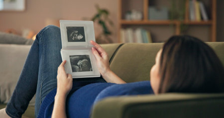 Woman, pregnant and relax on sofa with ultrasound, thinking and prenatal care in home. Future mom,...