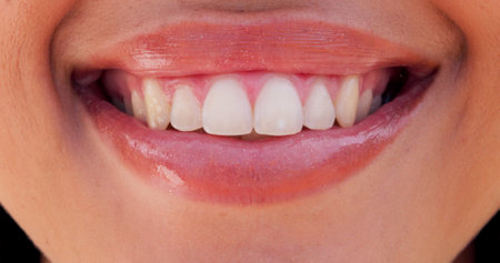 Happy, beauty and lips of woman with smile for confidence, pride and joy outdoors for dental wellness. Facial expression, cheerful and closeup of person with gloss for health, hygiene and oral careの写真素材