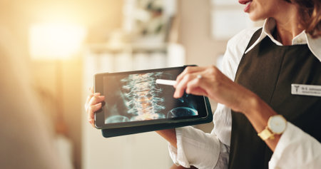 Doctor, hands and xray on tablet in clinic for explaining medical diagnosis, spinal tumor and cancer cells. Neurologist, woman and digital screen for anatomy scan, surgery feedback and health supportの写真素材