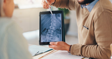 Xray, spine and tablet screen with hands of doctor and old person for consulting, orthopedic expert and meeting. Healthcare, medical and mri scan with closeup for osteoarthritis, advice and anatomyの写真素材