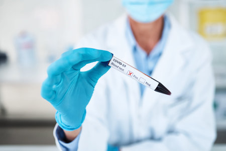Scientist, hands and blood test with positive for covid results, exam or sample at laboratory....