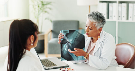 Appointment, healthcare or x ray with doctor and patient in office of hospital for consulting. Conversation, medical or radiology with mature medicine professional and woman in clinic for diagnosisの写真素材