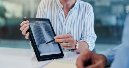 Hands, doctor and patient with tablet screen, xray for lungs and healthcare with support. People, closeup and medical with professional, tech and diagnosis with wellness, feedback for test or talkの写真素材