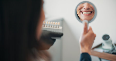 Happy woman, mirror or patient in dental clinic for crown, veneers or medical procedure. Reflection, smile or person with implant in oral exam for dentistry, teeth whitening or cosmetics treatmentの写真素材