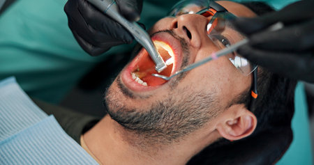 Man, patient and dentist with mouth tools for cleaning, bacteria or germ removal at orthodontist....