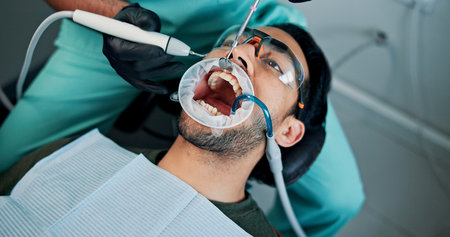 Cleaning, man or mouth procedure in dental clinic for toothache, veneers and medical surgery. Appointment, operation or patient in oral exam for dentistry, teeth whitening and cosmetics treatmentの写真素材