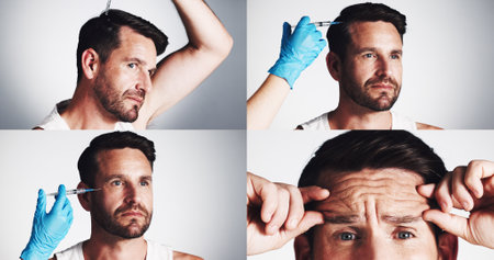 Anti aging, needle and man in collage for skincare for filler injection, hair growth or aesthetic treatment. Collagen benefits, wrinkles or studio with alopecia cosmetics or serum on white backgroundの写真素材