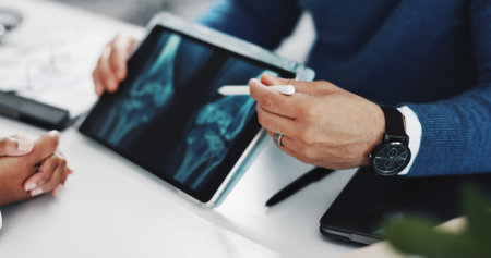 Doctor, consulting or hands on tablet screen for x ray with knee injury, osteoporosis or tendon...