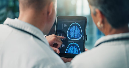 Hands, doctors and tablet for brain scan, neurology and MRI on screen for team collaboration at...