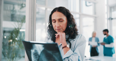 Woman, doctor or thinking with x ray in hospital for examination, medical procedure or test results....