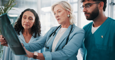 Doctors, x ray and people in clinic, teamwork or diagnosis with help, feedback or healthcare....