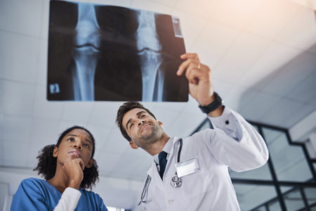 Doctors, teamwork or xray analysis in hospital for joint dislocation, results or surgery planning....