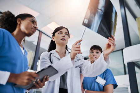 Women, doctor and nurse for xray, review and healthcare for knee treatment in hospital. Low angle, surgery advice or discussion with radiology study, consultation or bone marrow transplant in clinicの写真素材