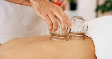 Hands, glass and cupping therapy for back pain, healing and relax for muscle blood flow and benefits. Therapist, holistic spa and person on bed for wellness, health or resort with deep tissue massageの写真素材
