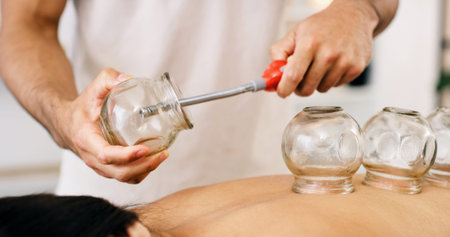 Hands and cupping therapy for back pain, relax and healing for muscle blood flow benefits....