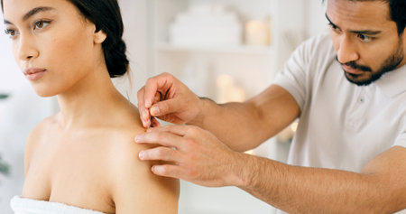 Therapist, woman and shoulder in spa with acupuncture, stress relief and traditional Chinese medicine. Expert, person and wellness at retreat with needle, ancient healing method and pain management.の写真素材