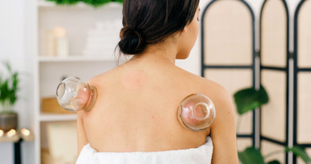Spa, back of woman or cupping therapy with suction for blood circulation, muscle tension or healing. Cups, female person or ancient medicine at wellness center for pain relief and deep tissue massageの写真素材