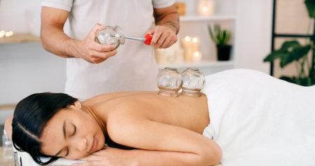 Woman, spa and cupping therapy for back pain, healing and relax for muscle blood flow and benefits. Therapist, person and patient on bed for wellness, health and resort with deep tissue massageの写真素材