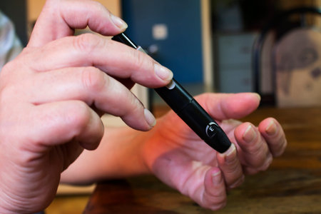 Woman with diabetes taking blood sample from her finger with black pen