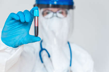 Female doctor or nurse in protective suit and face shield holding a positive blood test result for coronavirus or covid-19.の写真素材
