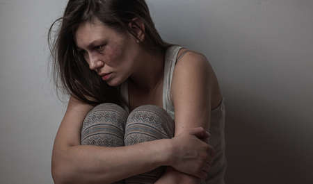 Domestic violence, abuse woman with bruise on faceの写真素材