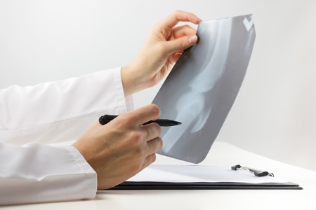 Healthcare and medicine concept - doctor with medical clipboard analyzing leg knee roentgen or x-ray radiography examinationの写真素材