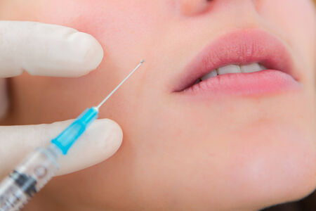 Detailled close up view of a lip injectionの写真素材