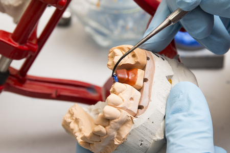 hands of dentist working on a dental implant mold