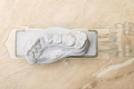 Dental mold and models with prosthetic teeth for cermet in the dental lab