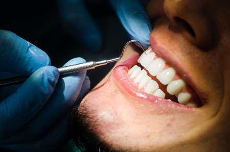 Young male patient takes a dental attendance in the dentists office.の写真素材