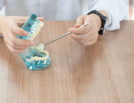 Implant dental model in dental care concept.