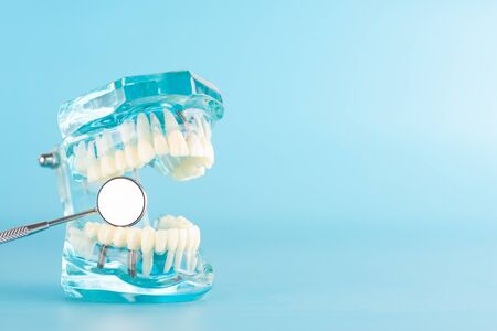 Dental implant model on blue background.