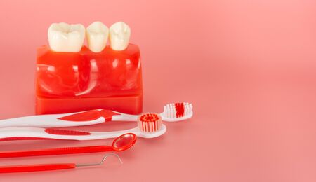 Example of Implants and dental tools for use in explaining let patients be informed of the treatment process.の写真素材