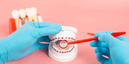Examples of dental implants made from silicone demonstrate components of dental implants. When...