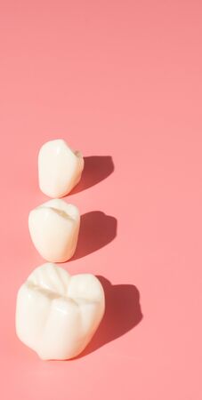 Examples of dental implants made from silicone demonstrate components of dental implants. When...