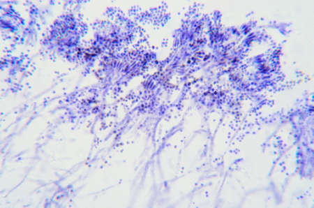 Penicillium branches, ascomycetous fungi under the microscope. To humans ascomycetes are a source of...
